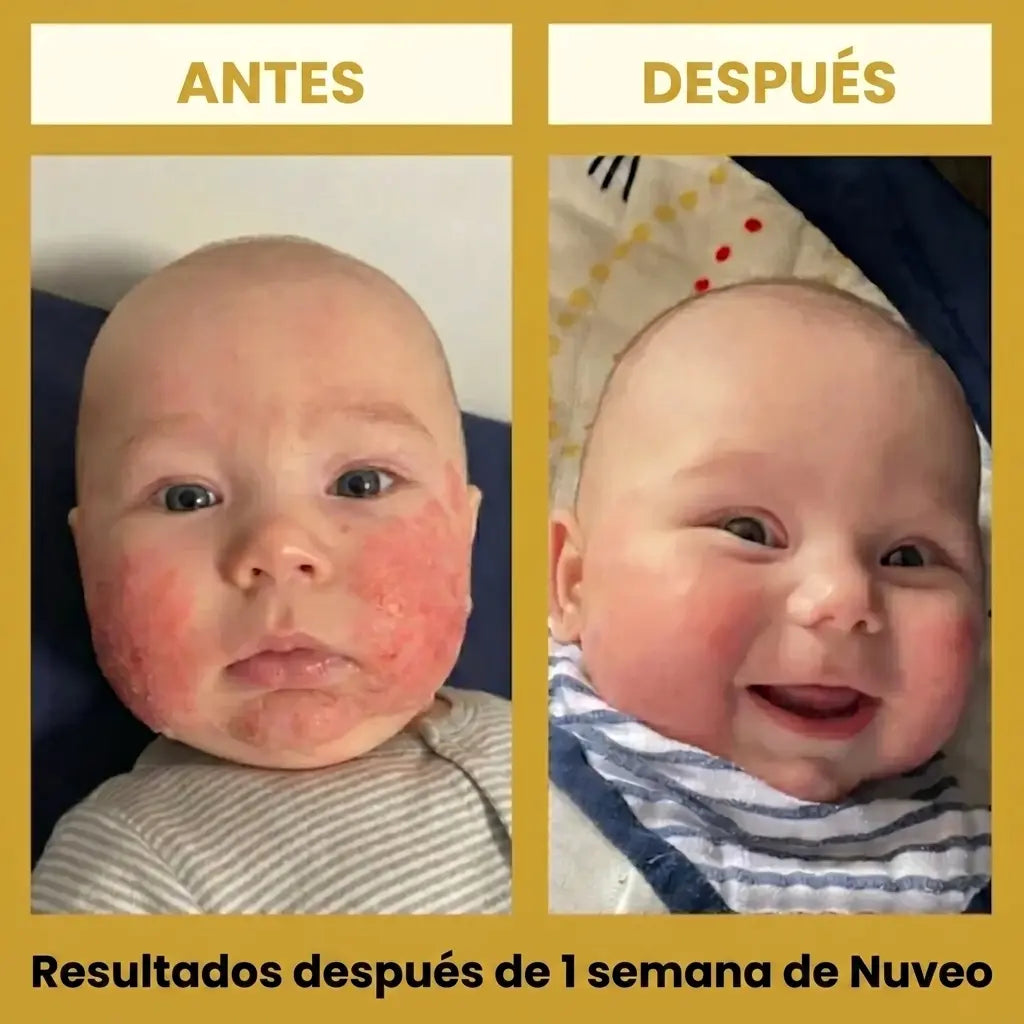 Nuveo™ Crema de Miel para Eccema
